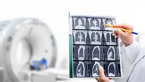 Radiologist showing tomography scan of a patient's lungs over of CT machine. Treatment of lung diseases, pneumonia, coronavirus, covid, cancer, tuberculosis