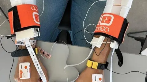 Terapia experimental para el manejo del temblor_2