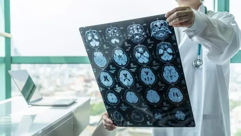 Resonancia cerebro medico