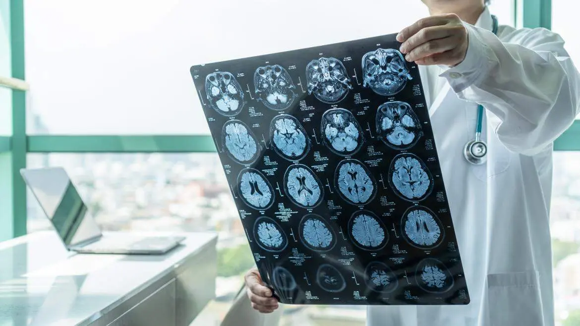 Resonancia cerebro medico