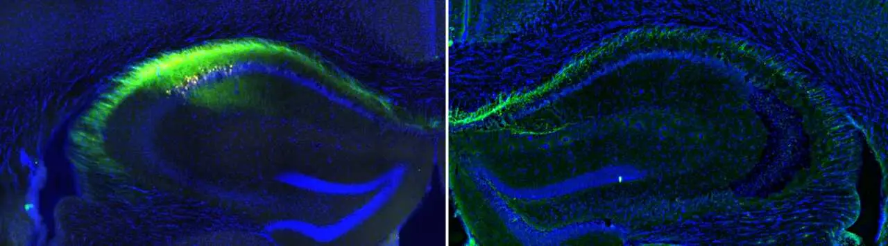 Hipocampos de rat&oacute;n con las conexiones neuronales (verde) que conectan ambos hemisferios. / IN-CSIC-UMH
