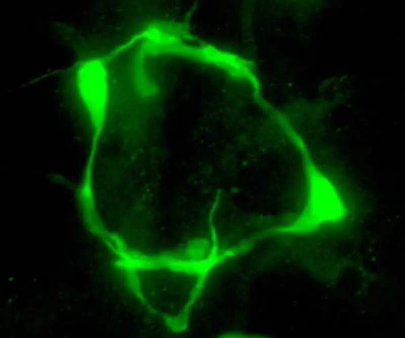 Marca de serotonina en las neuronas VC del nematodo C. elegans modificado gen&eacute;ticamente. / Andrea Mill&aacute;n-Trejo (IBV-CSIC)