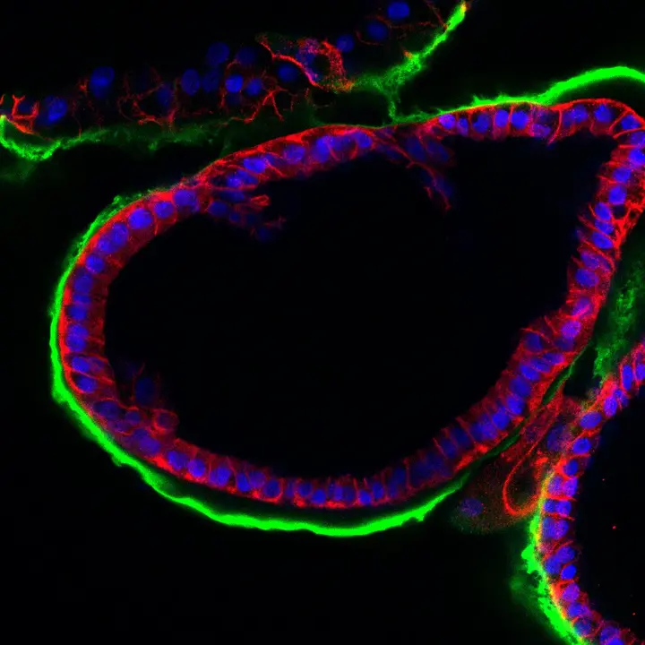 Composite CDH DAPI LAM