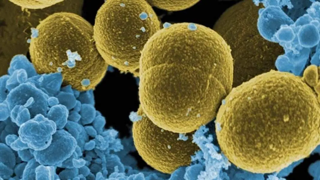 Bacteria &lsquo;S. aureus&rsquo; escapando de la destrucci&oacute;n por leucocitos humanos./ Wikimedia