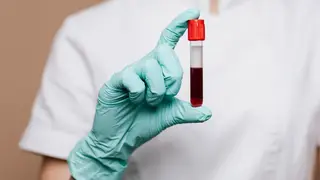 Donar sangre - Foto rawpixel.com