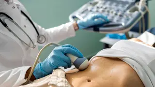 El carcinoma hepatocelular es un tumor especialmente agresivo y dif&iacute;cil de tratar. / iStock.