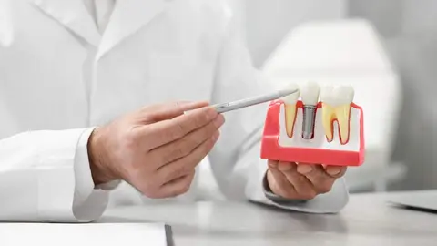 Implantes - Gatty imágenes
