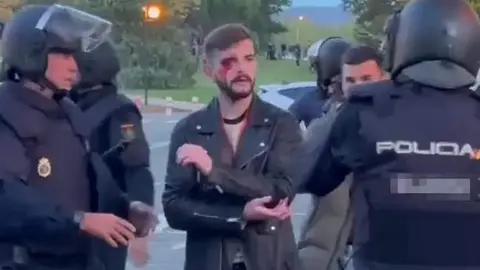 Periodista agredido ayer en la Universidad de Navarra