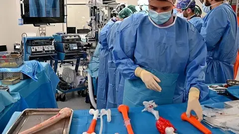 FOTOS OSTEOSARCOMA NIÑOs - Comunidad de Madrid