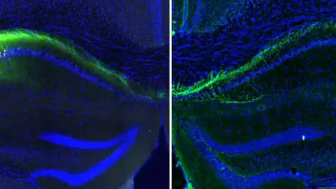 Hipocampos de rat&oacute;n con las conexiones neuronales (verde) que conectan ambos hemisferios. / IN-CSIC-UMH