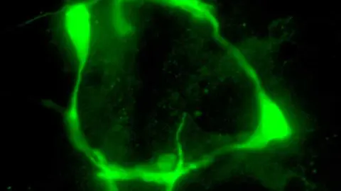 Marca de serotonina en las neuronas VC del nematodo C. elegans modificado gen&eacute;ticamente. / Andrea Mill&aacute;n-Trejo (IBV-CSIC)