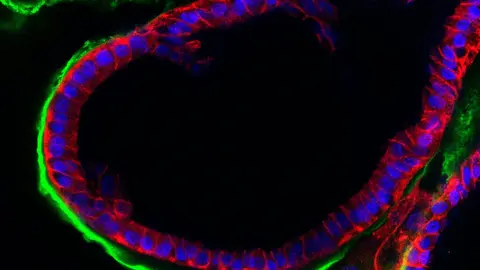 Composite CDH DAPI LAM