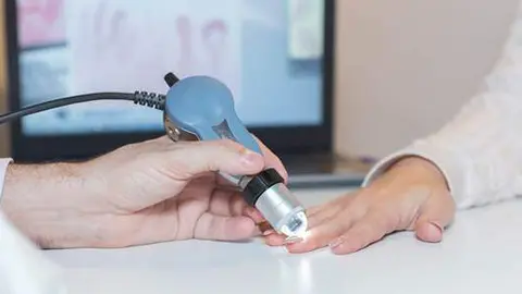 Uno de los s&iacute;ntomas de la esclerodermia es el engrosamiento de la piel de los dedos. / iStock