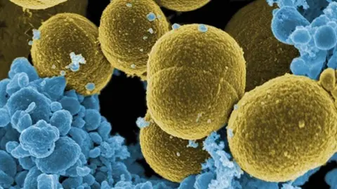 Bacteria &lsquo;S. aureus&rsquo; escapando de la destrucci&oacute;n por leucocitos humanos./ Wikimedia