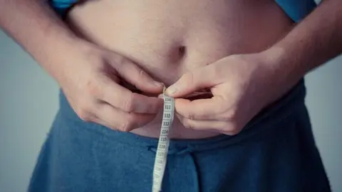 Foto del D&iacute;a Mundial de la Obesidad