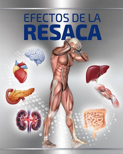 Efectos de la resaca